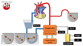 Cardiopulmonary bypass CPB circuit [upl. by Rianon172]