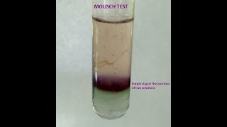 Molisch Testa group test for Carbohydrates [upl. by Baryram]