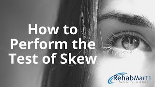 How to Perform the Test of Skew for Vertigo [upl. by Hiroko]