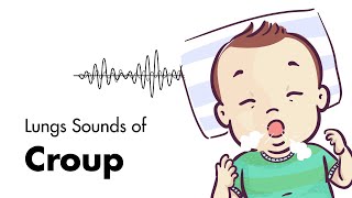 Sounds of Croup Laryngotracheitis  Lung Sounds  MEDZCOOL [upl. by Anrak713]