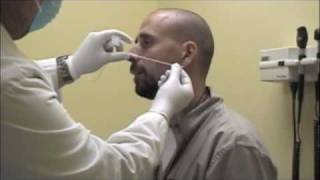 Procedure for Nasopharyngeal Swabs and Aspirates [upl. by Nnylamme]