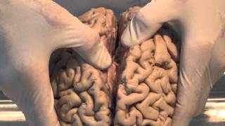 Introduction Neuroanatomy Video Lab  Brain Dissections [upl. by Yoshio]